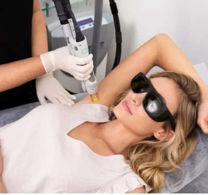 Laser Hair Removal in Davie: Your Guide to Smooth, Hair-Free Skin